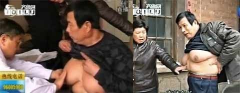 Nhiều người hàng xóm trêu chọc anh Guo vì bộ ngực phụ nữ này